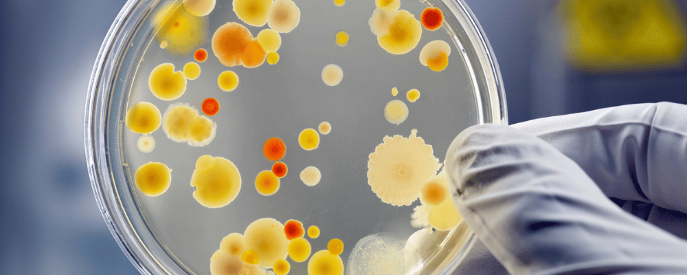 Petrischale mit Bakterien
