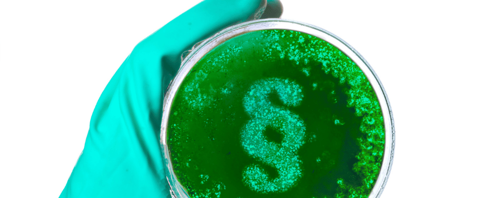 Hand im Handschuh mit Petrischale 